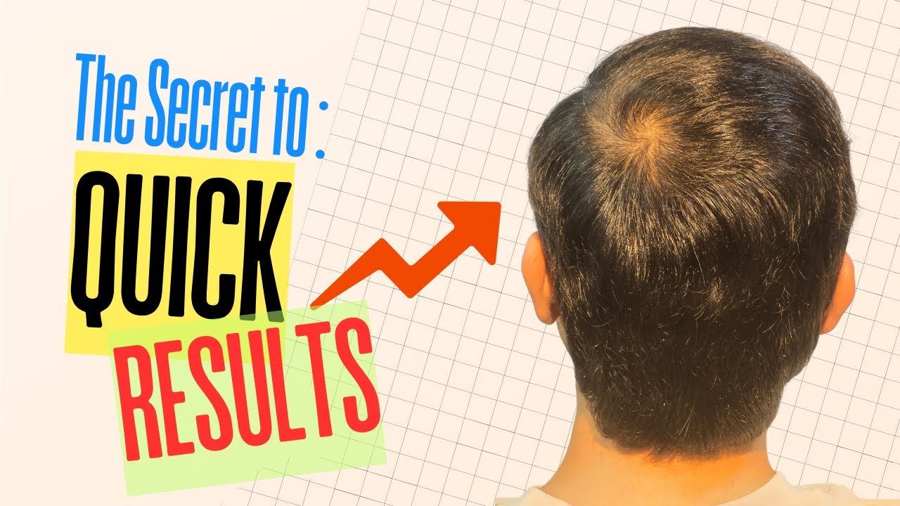 Timeline after hair transplant in India for Best hair transplant Results