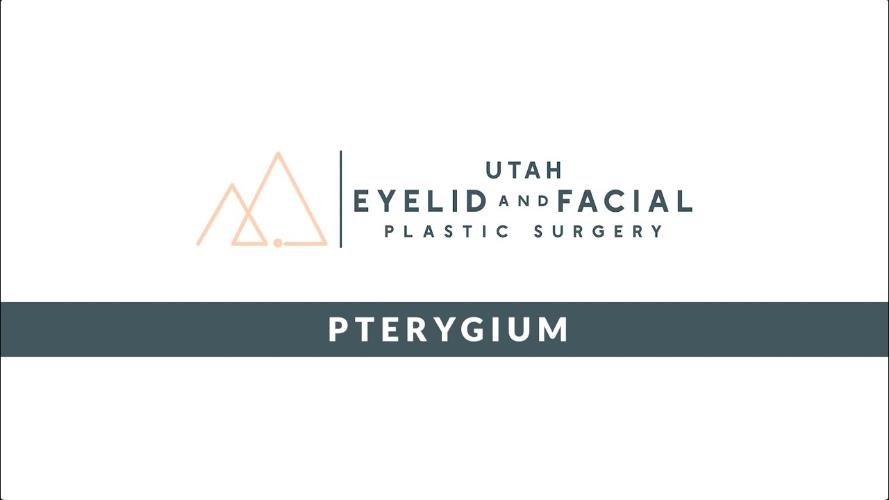 Pterygium