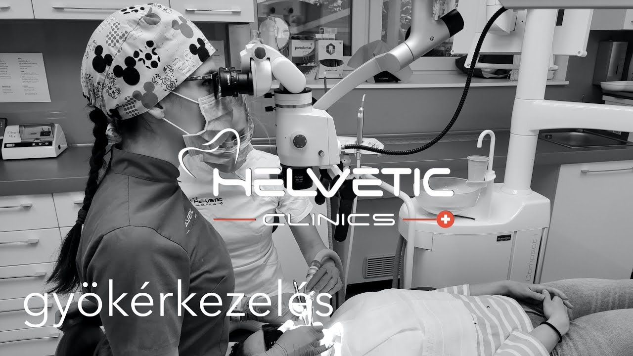 Gyökérkezelés - amit érdemes tudnia  - Helvetic Clinics - Dr.  Csák Boglárka