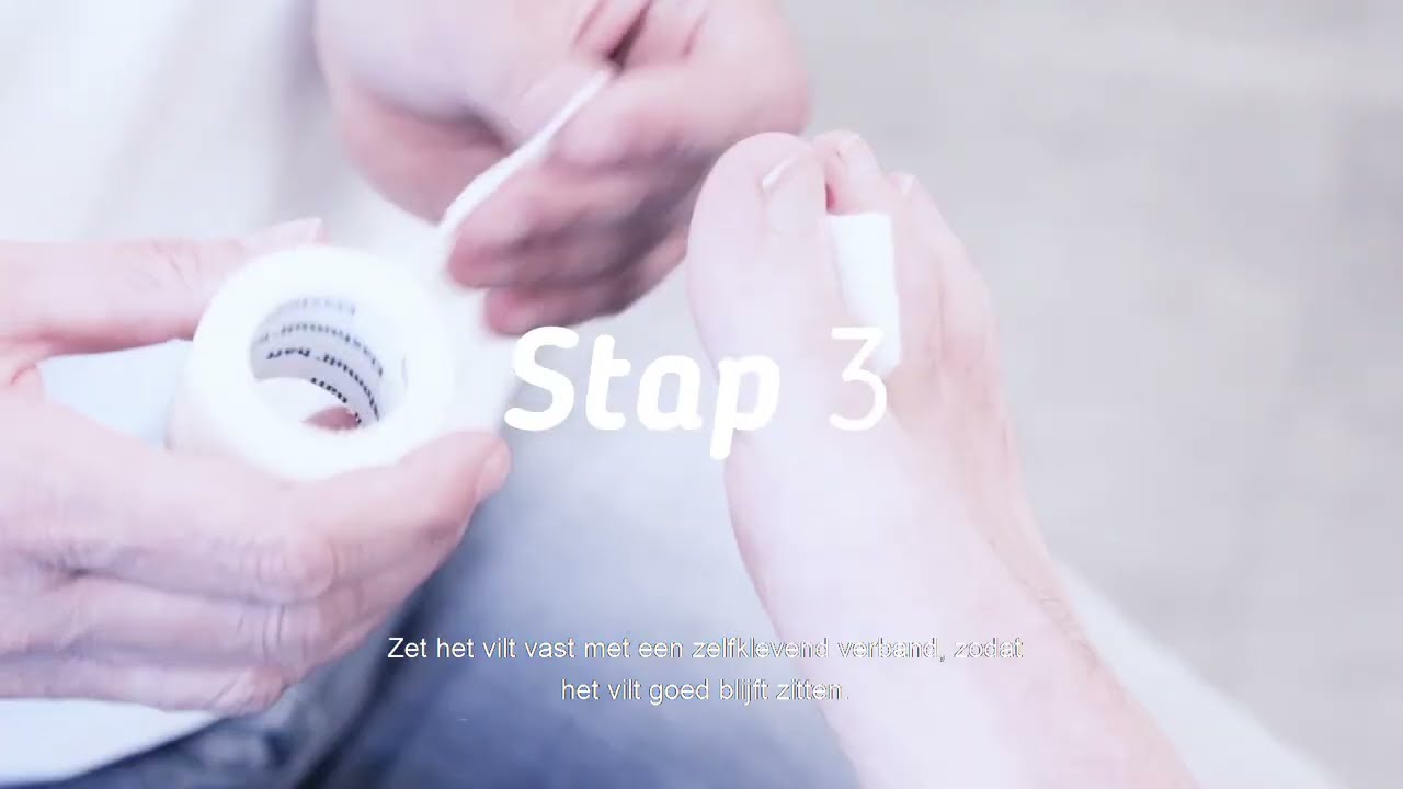 Instructievideo - Een wond tussen de tenen drukvrij leggen