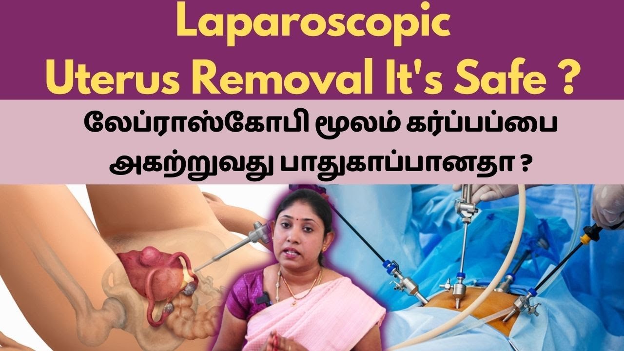 Laparoscopic Uterus Removal!! IsIt Safe ? லேப்ராஸ்கோபி மூலம் கர்ப்பப்பை அகற்றுவது பாதுகாப்பானதா ?