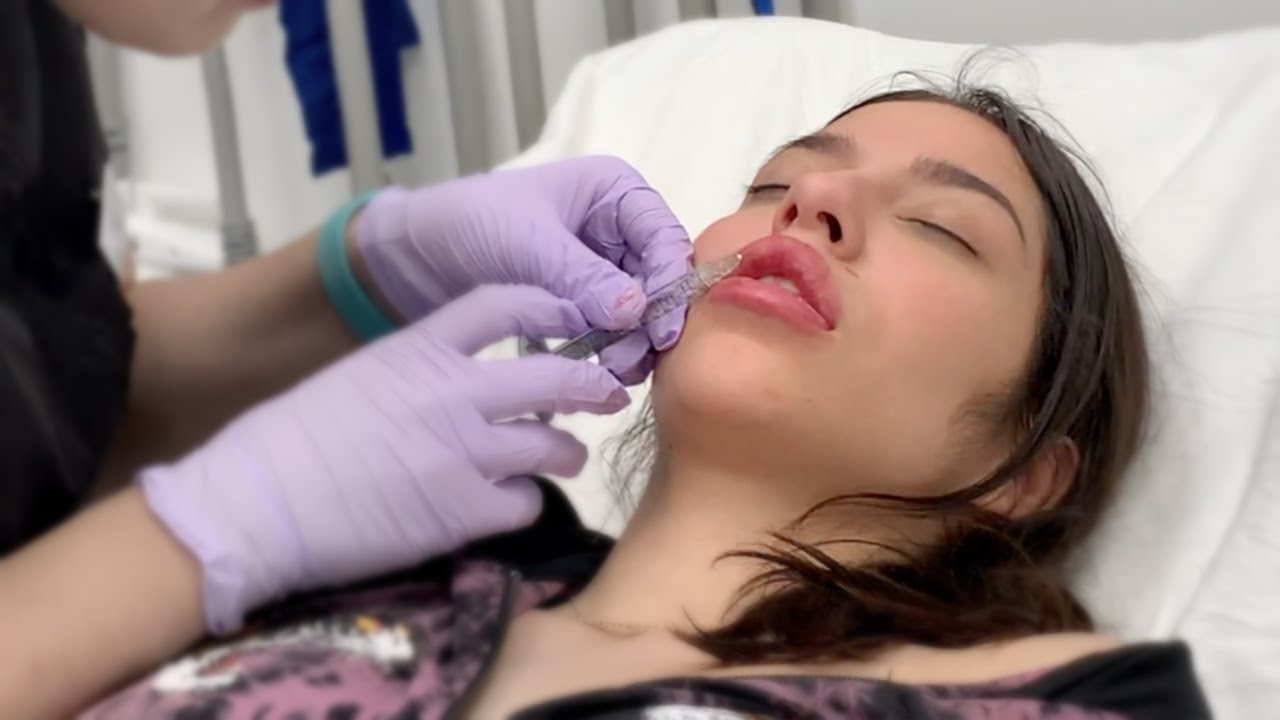 BEST FRIEND GETS LIP INJECTIONS! (VLOG) | Mel Joy