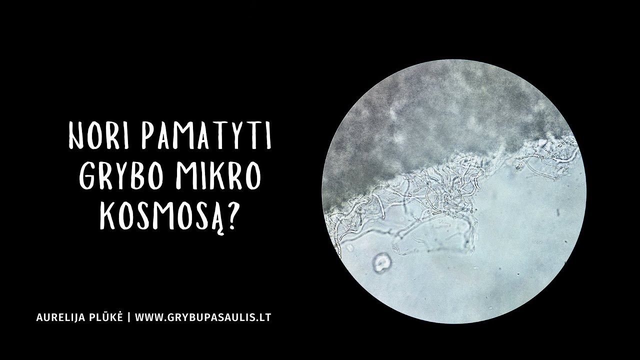 Nori pamatyti, kaip atrodo grybas, paki&scaron;tas po mikroskopu?