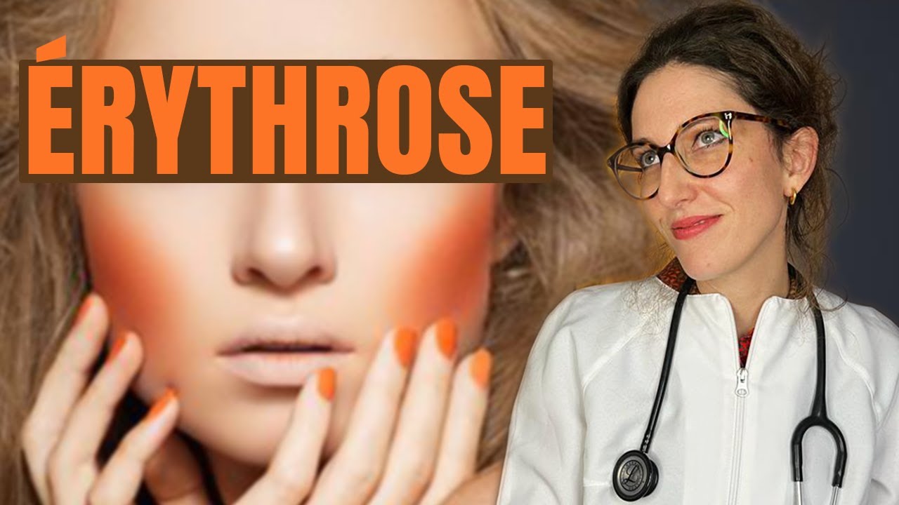 CAUSES ET TRAITEMENTS DE L'&Eacute;RYTHROSE (les rougeurs du visage)