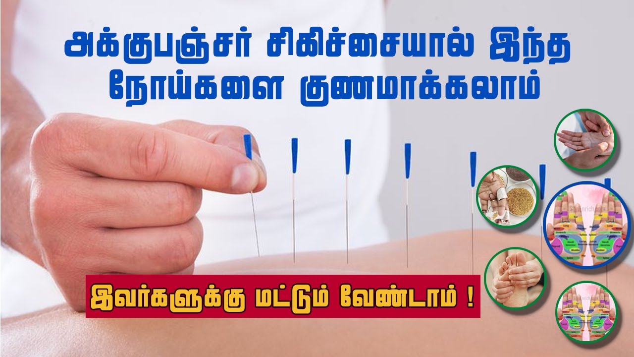 அக்குபஞ்சர் சிகிச்சை முறைகள் | நோய்களுக்கான தீர்வுகள்