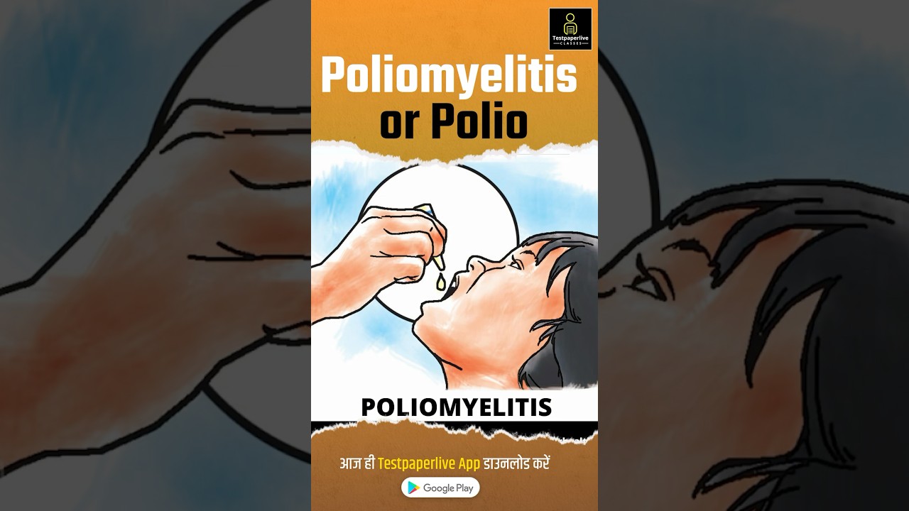 Poliomyelitis (Hindi) | Polio | Polio Virus , Causes, Signs and Symptoms #Polio #Poliomyelitis