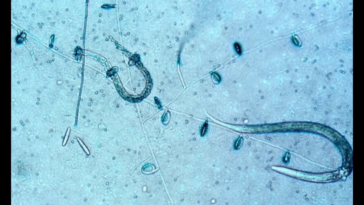 Importance of soil organisms with Dr Graham Stirling