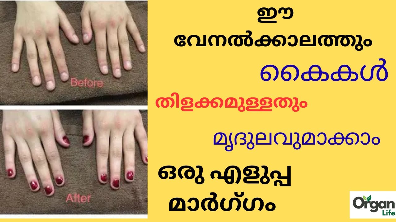 വേനല്ക്കാലത്തെ കൈകളുടെ സംരക്ഷണം ഒരു എളുപ്പമാർഗ്‌ഗം |ORGANLIFE