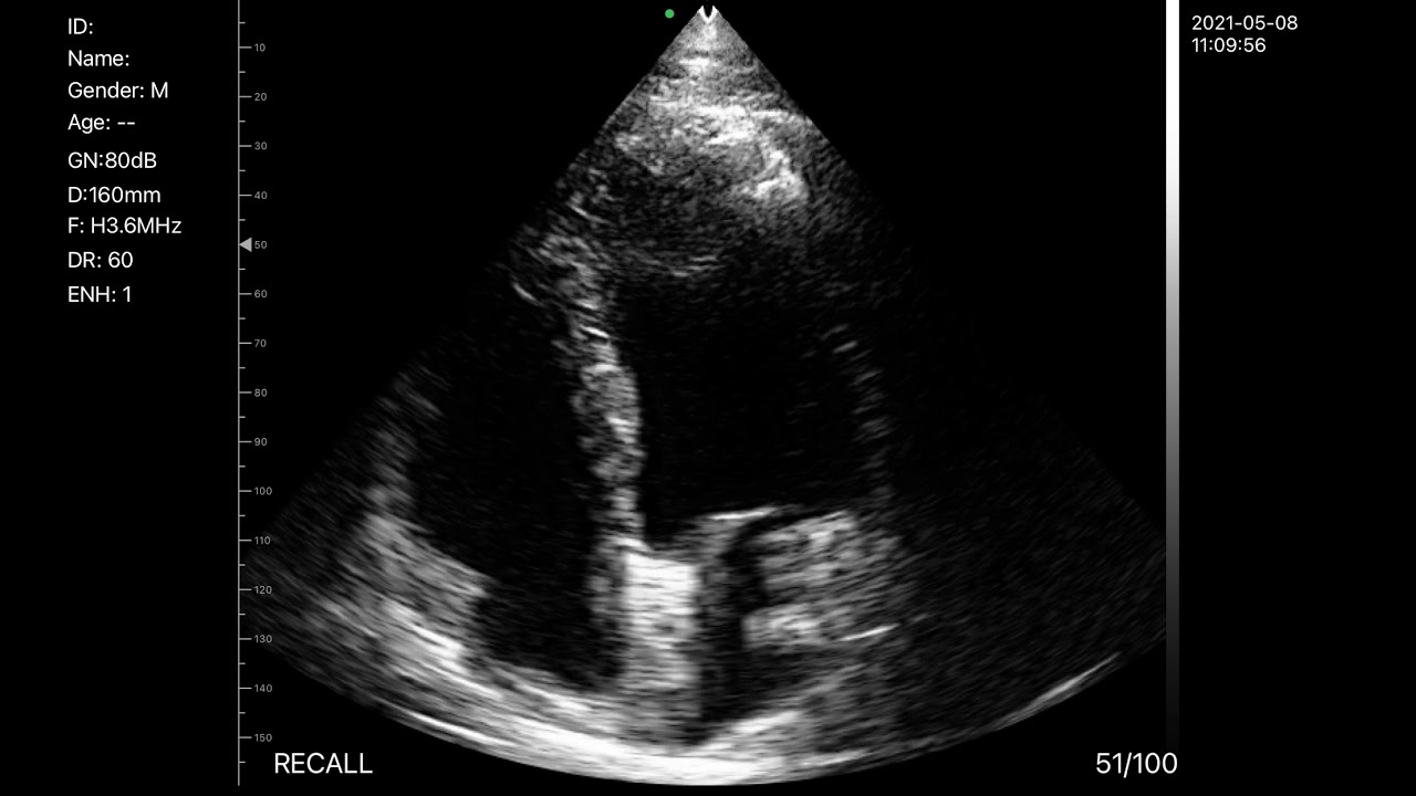 BIO-W7 Cardiac Color Doppler Probe