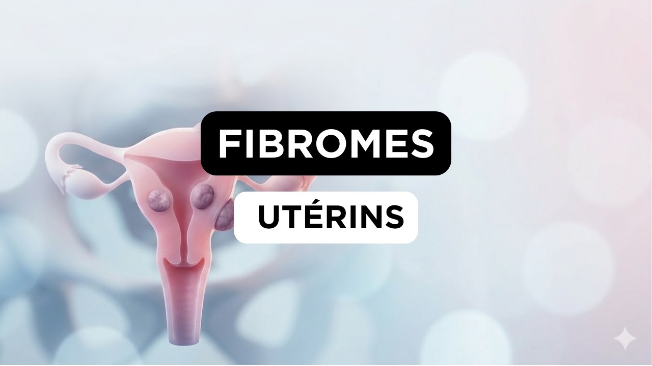 Fibromes Utérins : Causes, Symptômes Et Traitement