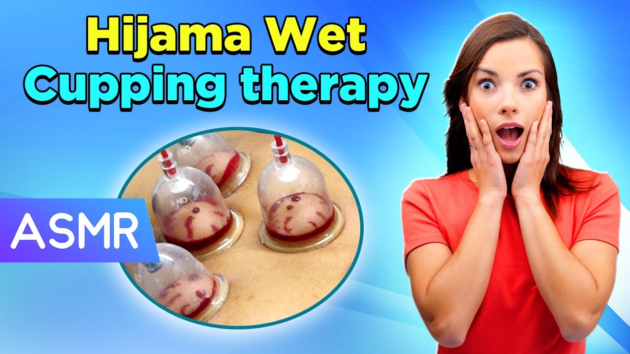Hijama Wet Cupping therapy for Eczema ASMR