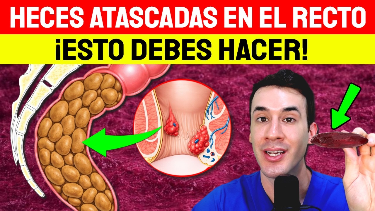 HECES ATASCADAS: ACTIVA tu INTESTINO y LIMPIALO de heces, gases y pedos INMEDIATAMENTE!