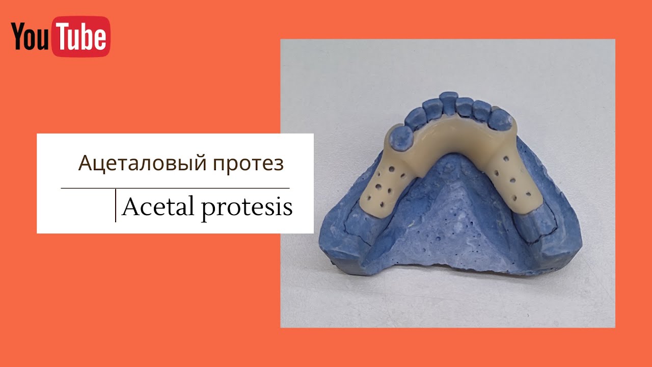 Ацеталовый протез | Acetal protesis