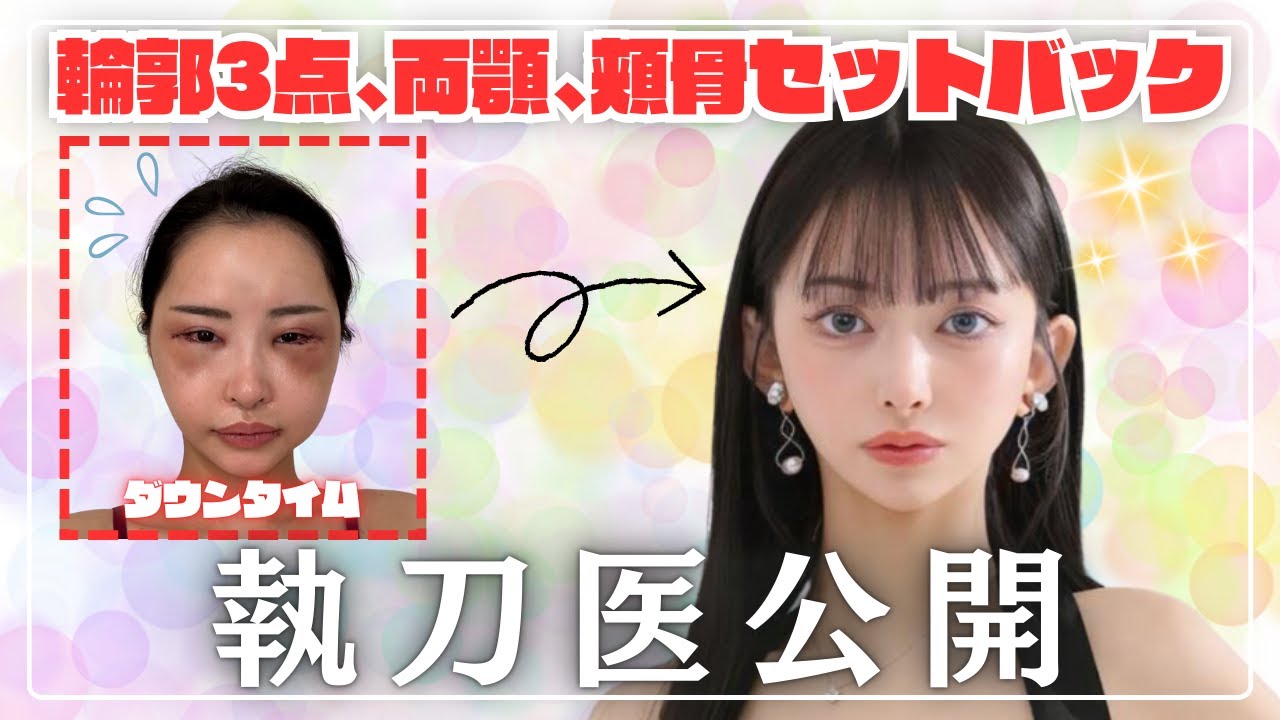 【執刀医公開】骨切り編