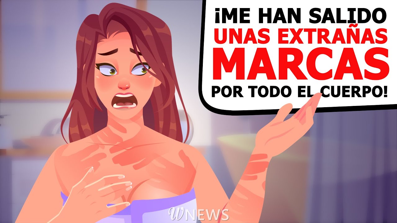 ¡Me han salido unas extrañas marcas por todo el cuerpo!