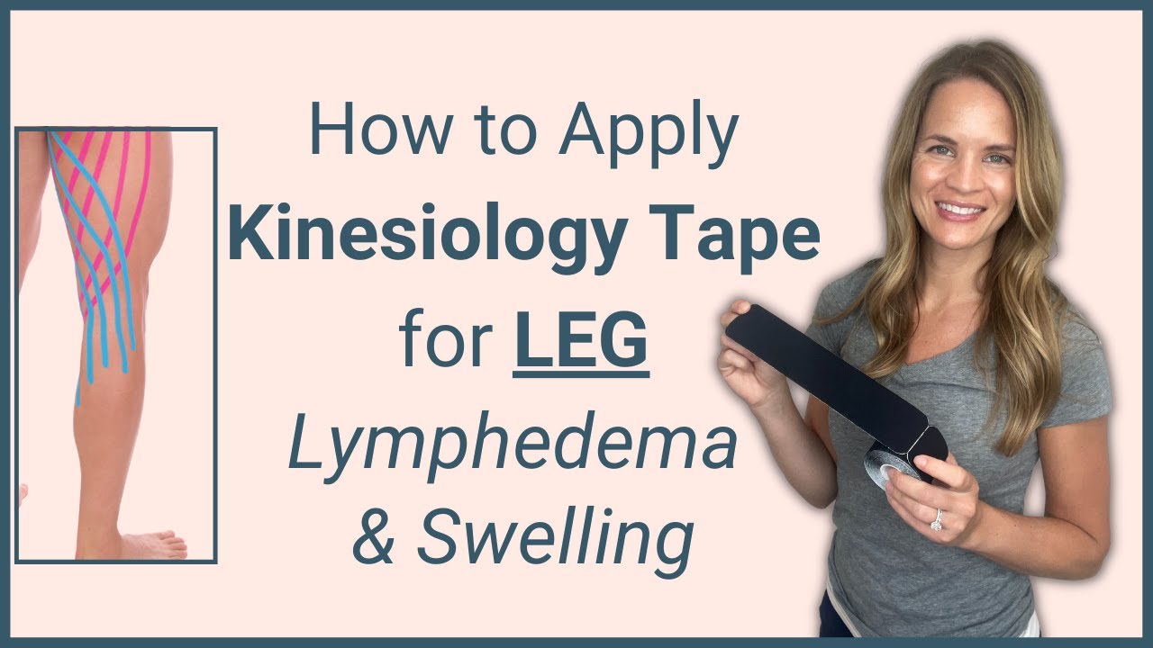 How to apply Kinesio Tape to a Leg for Lymphedema and Swelling