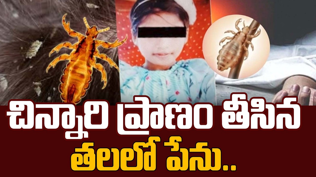 చిన్నారి ప్రా_ణం తీసిన తలలో పేలు! | Head Lice Infestation | Latest News | SumanTV Vali