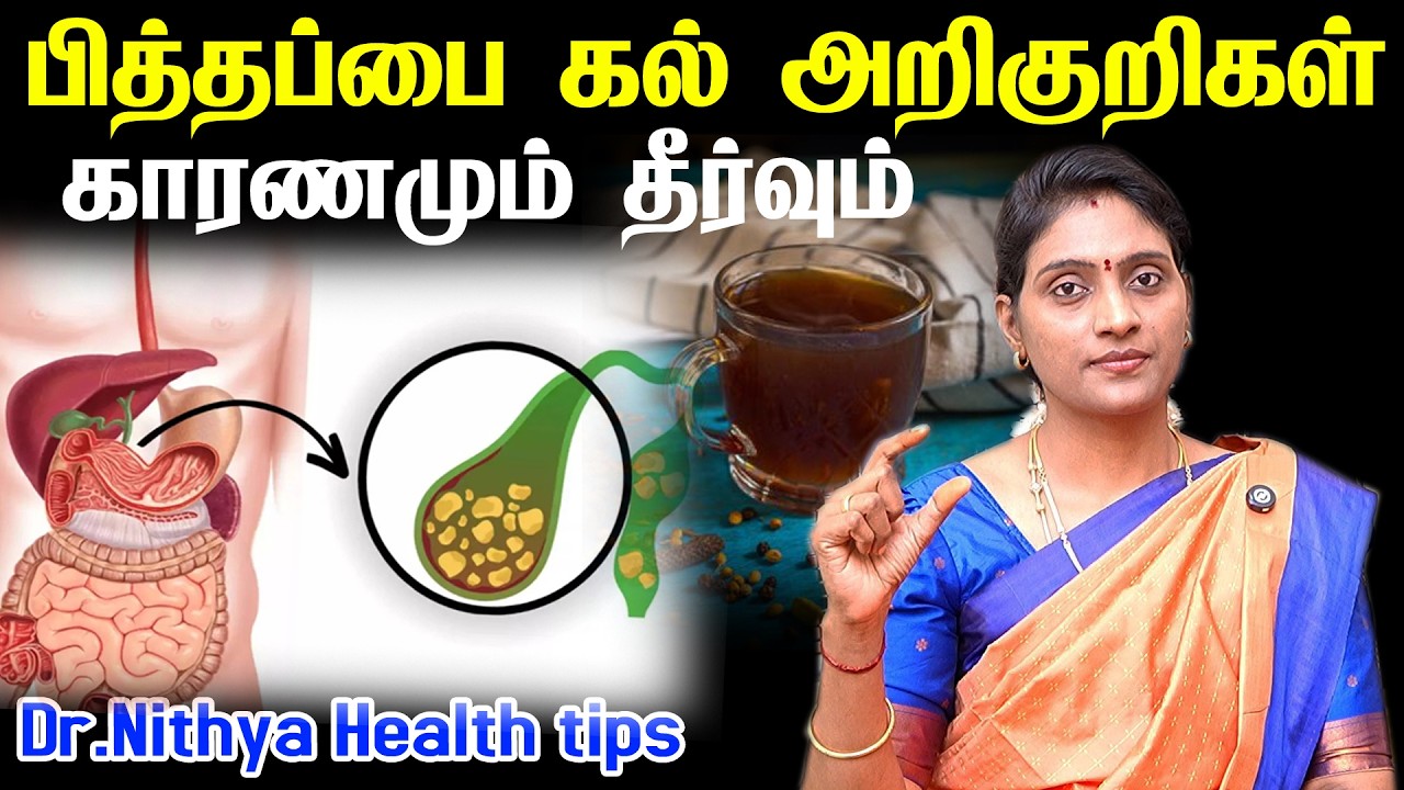 Gallbladder stone: பித்தப்பை கல் பற்றிய முழு விவரம் | என்னன்னு தெரிஞ்சுக்குவோம்  Gallbladder Stone