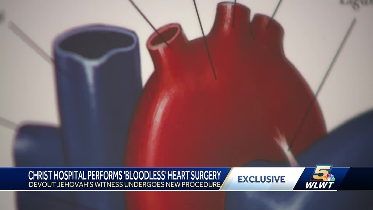 Christ Hospital performs bloodless heart surgery on devout Jehovah’s Witness
