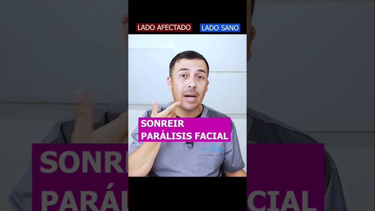 Par&aacute;lisis Facial sonriza #feibian #paralisisfacial #paralisis #masajes #masajefacial #fplg #fabian
