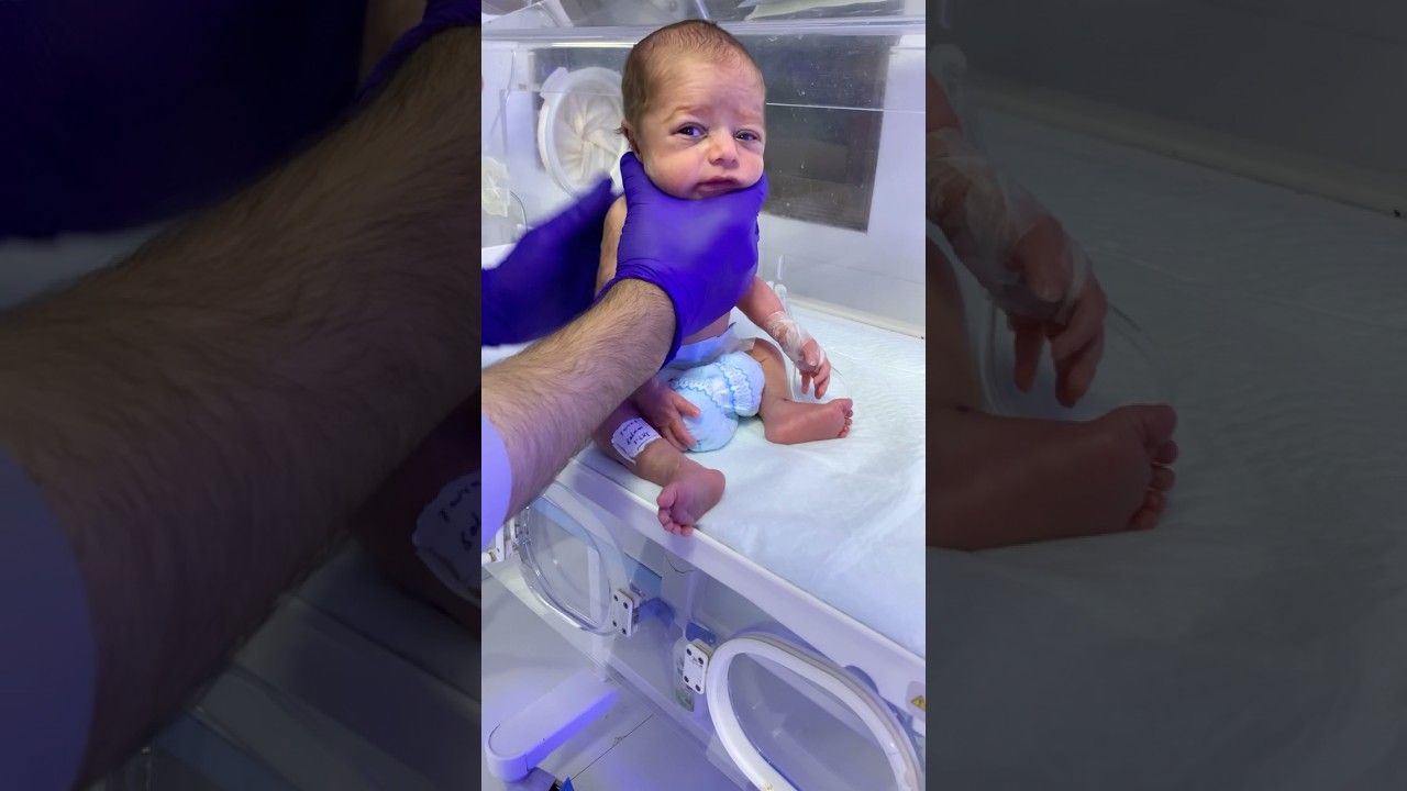 Newborn Baby&rsquo;s First Resuscitation in NICU | Nurse Care & Recovery👶💖 #babycare  #BabyResuscitation