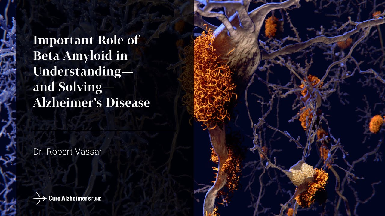 Important Role of Beta Amyloid to Alzheimer's Disease