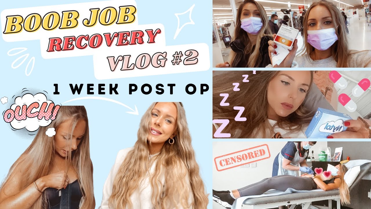BOOB JOB RECOVERY VLOG #2 - 1 week post breast augmentation surgery