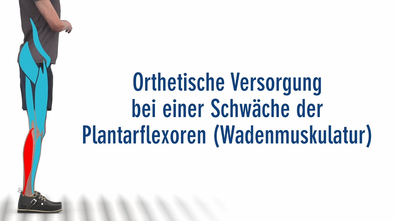 FIOR & GENTZ - Die richtige Orthese bei einer Lähmung der Plantarflexoren