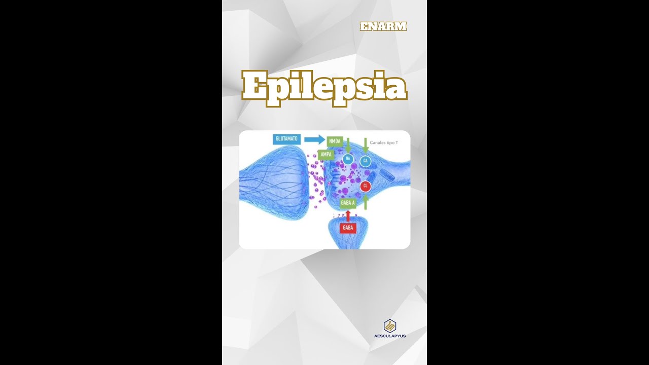 Epilepsia