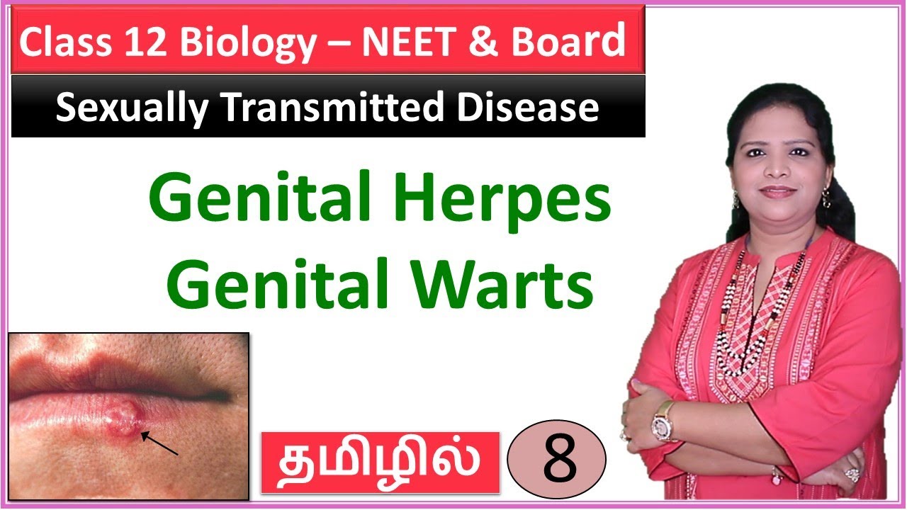 Genital Herpes and Genital Warts |  NCERT Class 12 Biology