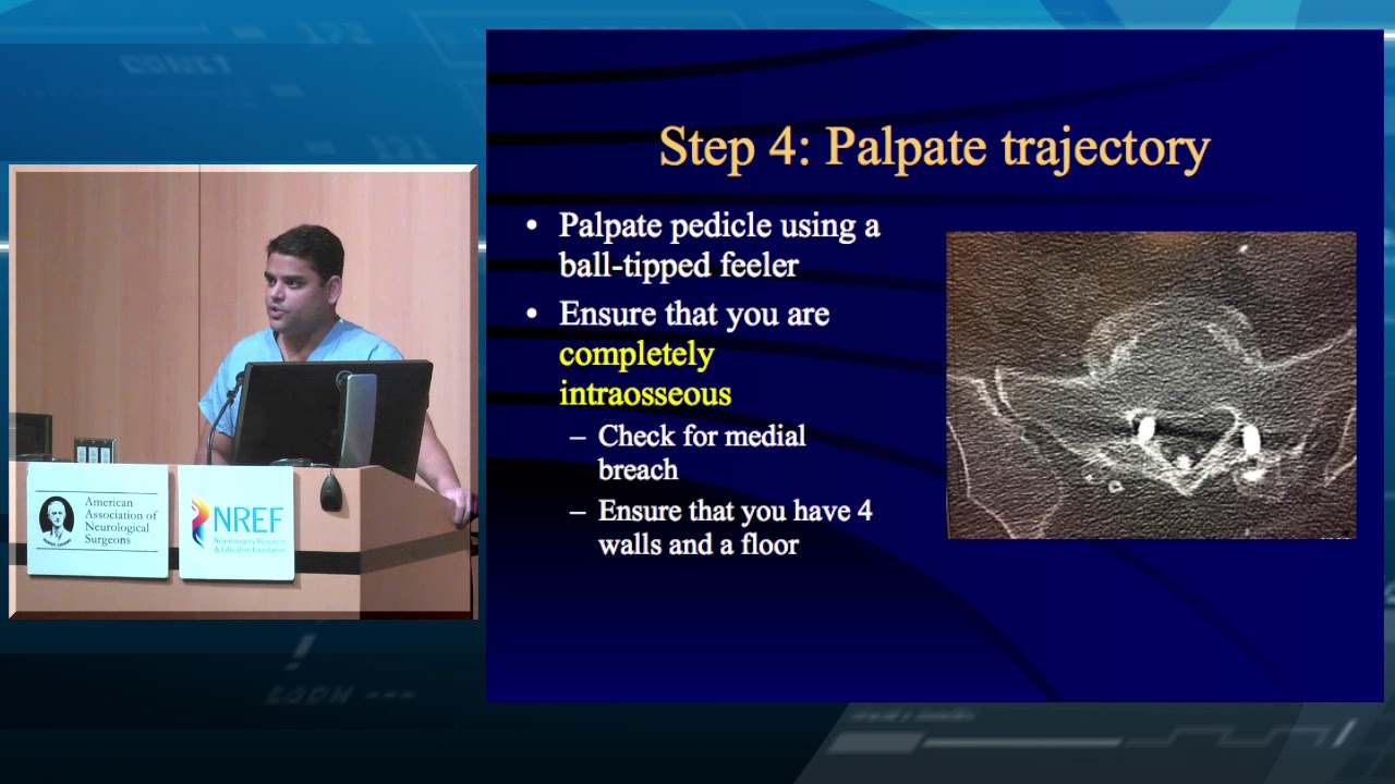 Lumbar Pedicle Screw Placement