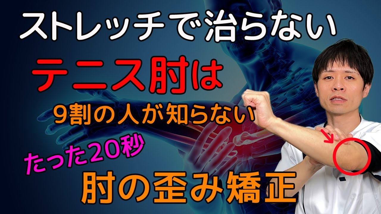 【20秒！テニス肘の治し方】ｽﾄﾚｯﾁで治らないテニス肘は、肘のズレを矯正することで肘の痛みを改善してください！【外側上顆炎】