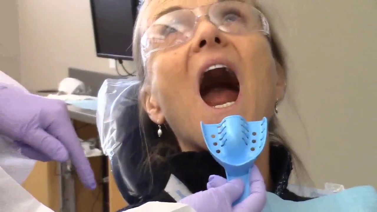 Alginate Impression Tutorial and Demo