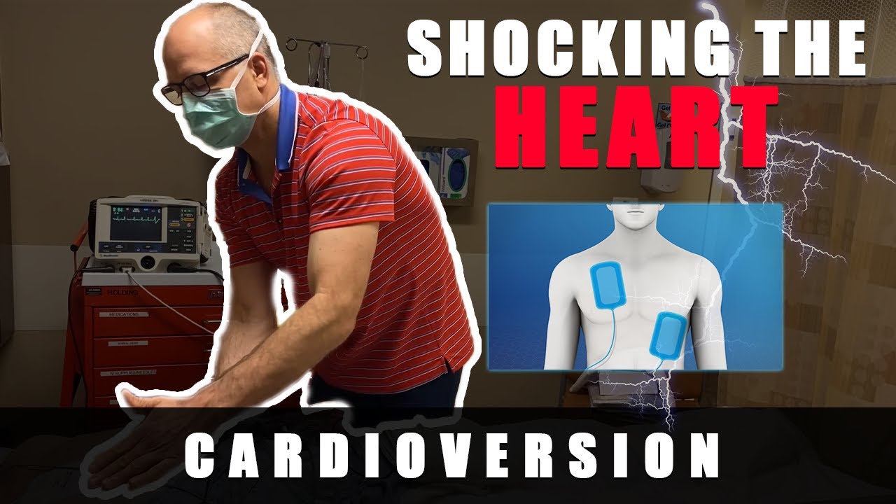 Atrial Fibrillation - Shocking The Heart Into Normal Rhythm With DC Cardioversion