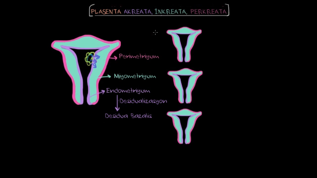 Plasenta Akreata (Fen Bilimleri) (Sağlık ve Tıp)