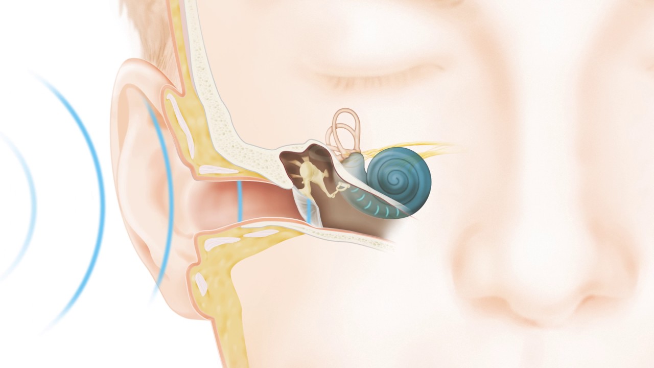 How Cochlear™ hearing solutions work: how natural hearing works