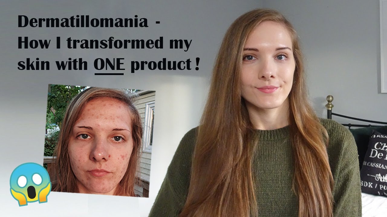 Dermatillomania - How I transformed my skin with ONE product! 😱 #skinpicking #dermatillomania