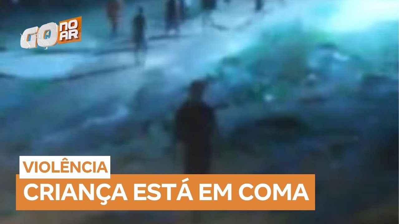 Menino de 11 anos &eacute; espancado e fica em coma ap&oacute;s ataque brutal em Caldas Novas (GO)