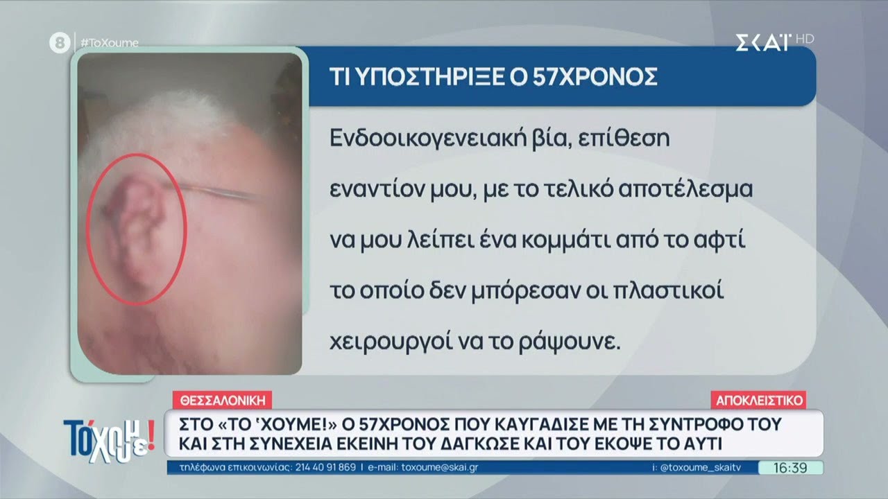 Θεσσαλονίκη: Γυναίκα δάγκωσε το αυτί του συντρόφου της μετά από καυγά με αφορμή μια γάτα | Το 'Χουμε