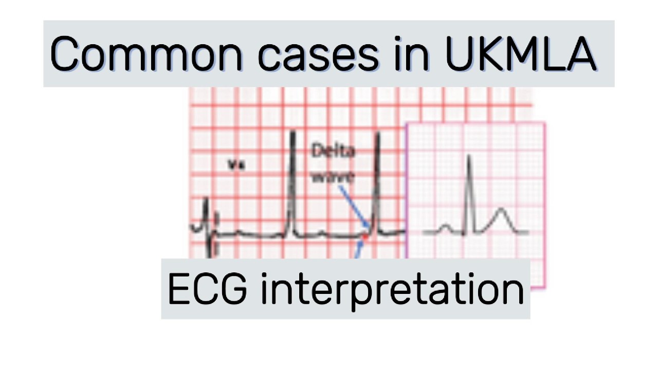 ECG in UKMLA