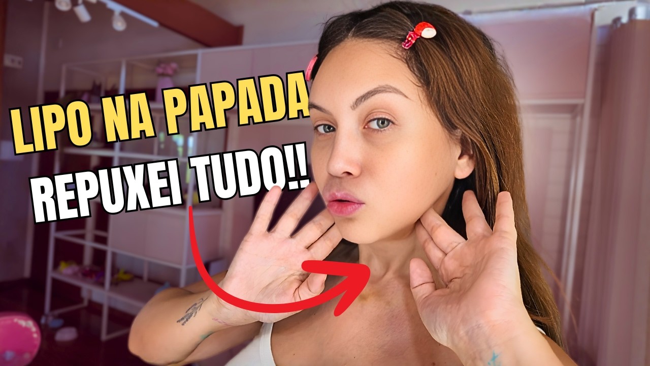 Antes de morar no Jap&atilde;o eu fiz isso...│Resultado da Lipo