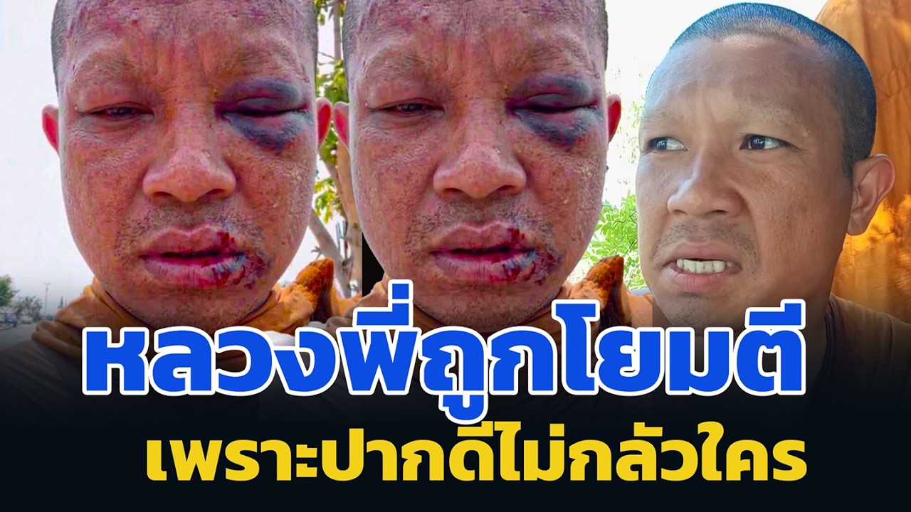 หลวงพี่ถูกโยมตี เดินบิณฑบาตร เพราะปากดีไม่กลัวใคร