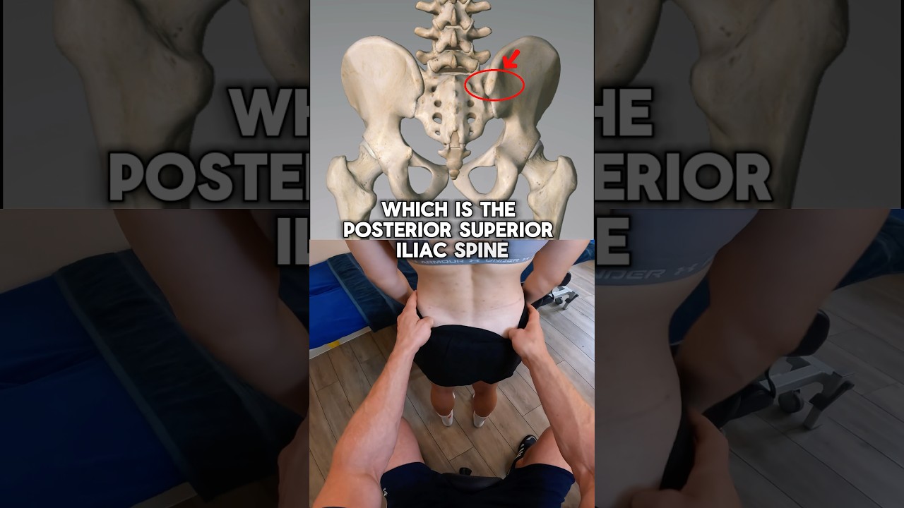 How to find the PSIS - basics of pelvis assessment