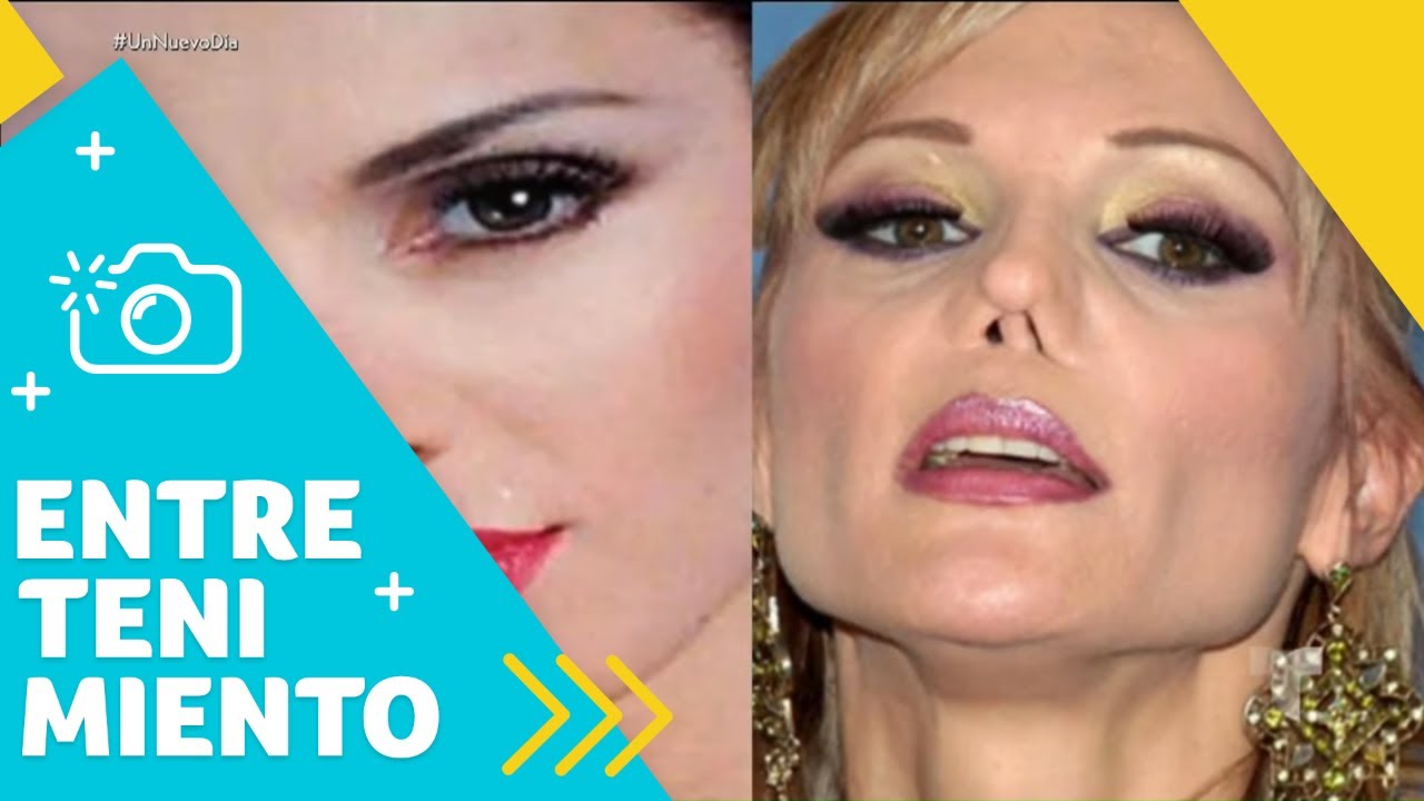 Carmen Campuzano: “La cocaína destruyó mi nariz” | Un Nuevo Día | Telemundo