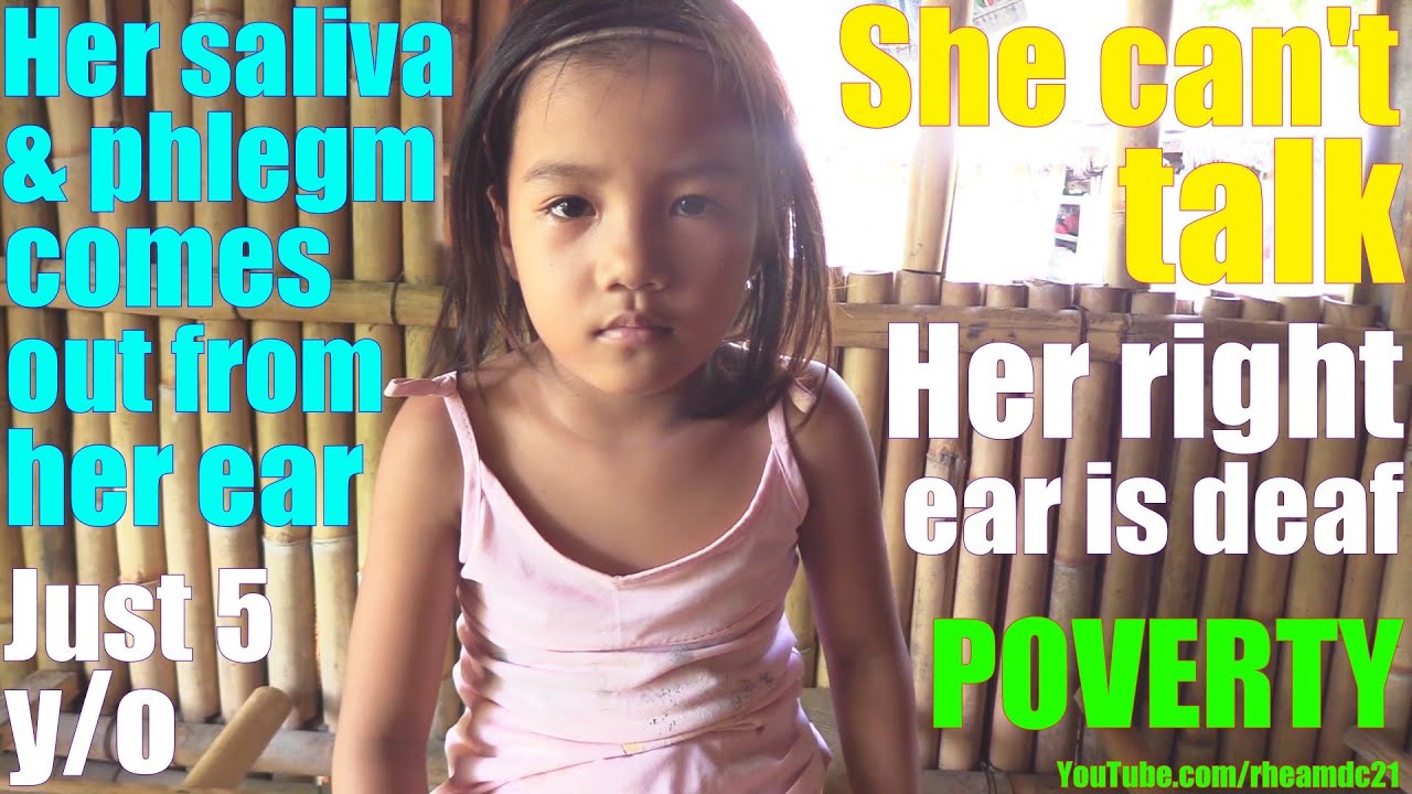 This Beautiful Poor Filipino Child Can't Hear and Talk. Filipinos Living in Poverty in Philippines