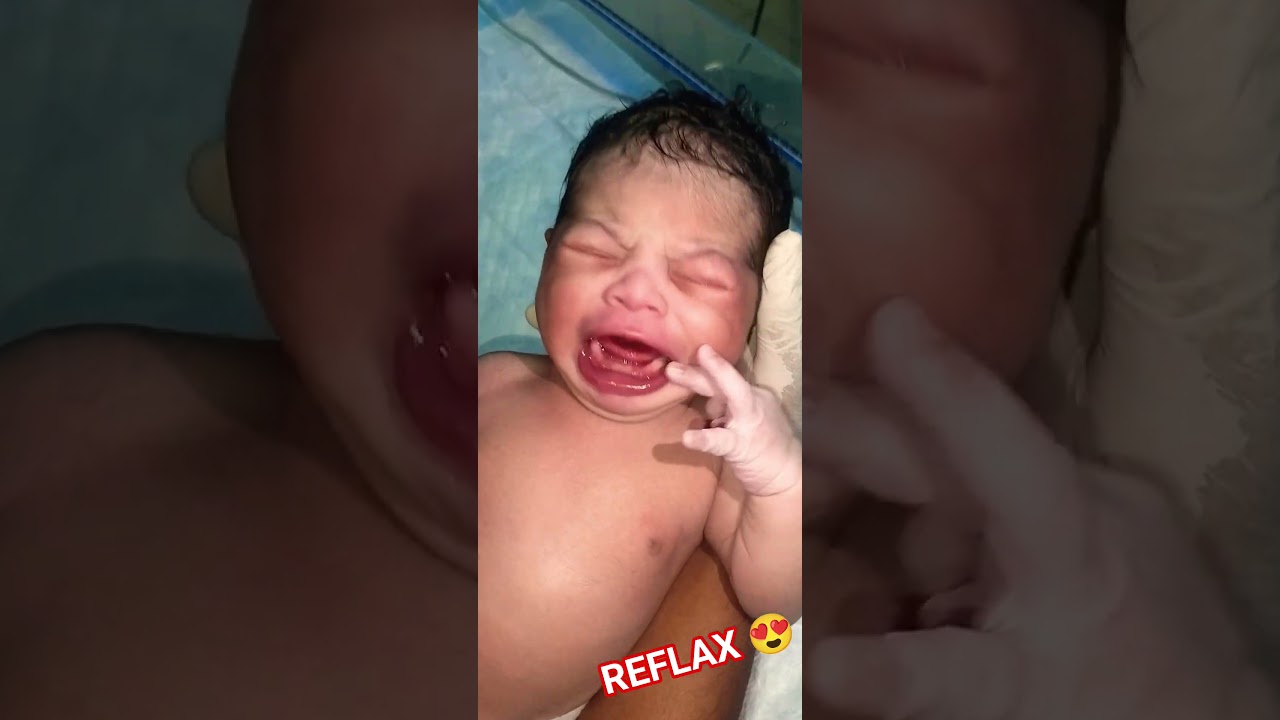 JUST BORNBABY AFTER REFLAX 😍 #trending #baby #youtubeshorts #viralvideo #shortvideos #nicu