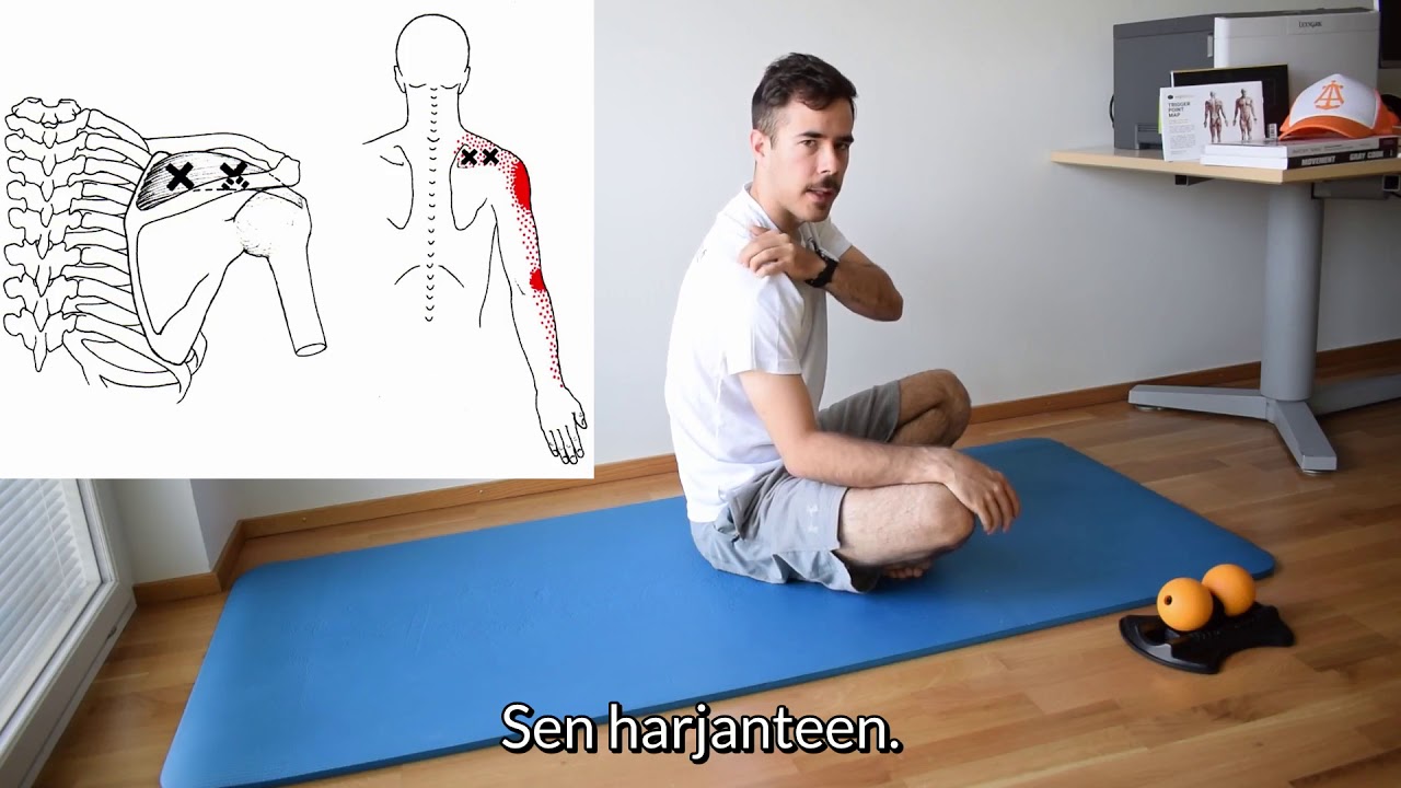 Olkapään kipuja aiheuttavat triggerpisteet