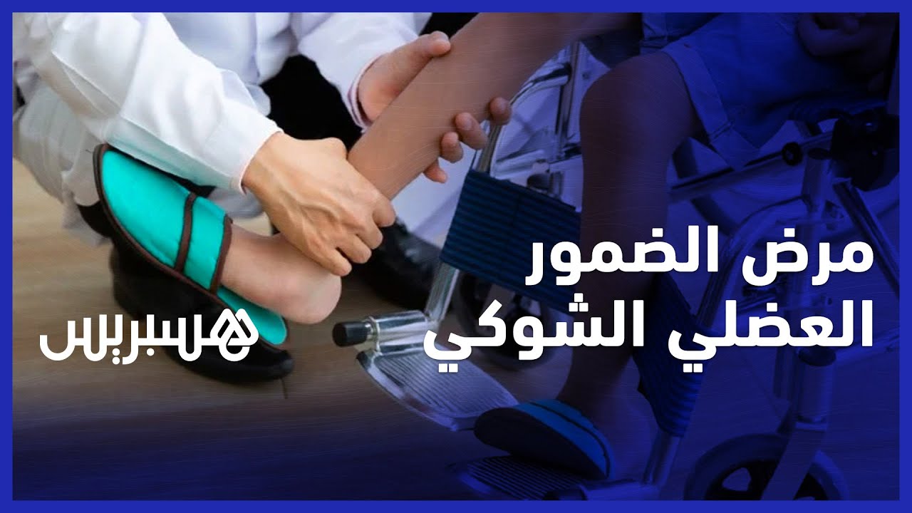 رئيس جمعية مرضى الضمور العضلي الشوكي يتحدث عن خطورة المرض وعدم توفر الأدوية بالمغرب