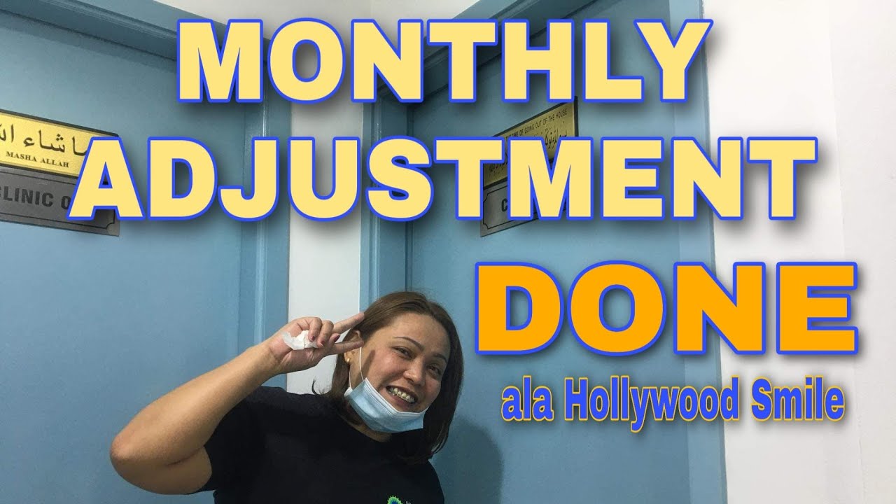 Kemirut TV @Hollywood Smile