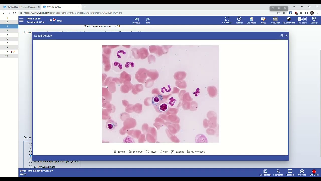 How To ANNOTATE First Aid  With UWORLD and use UW  Properly?